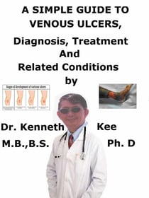 A  Simple  Guide  to  Venous Ulcers,  Diagnosis, Treatment  and  Related Conditions