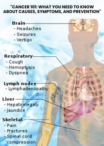 "Cancer 101: What You Need to Know About Causes, Symptoms, and Prevention"