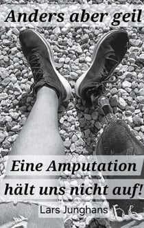Anders aber geil - Eine Amputation hält uns nicht auf!