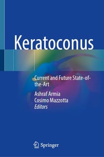 Keratoconus - Current and Future State-of-the-Art
