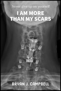 I Am More Than My Scars — Never Give Up On Yourself