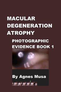 Macular Degeneration Atrophy, Photographic Evidence Book 1 - Macular Degeneration Atrophy, Photographic Evidence Series of   Books, #1