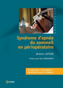 Syndrome d'apnée du sommeil en périopératoire - Physiologie   Techniques   Stratégies selon le terrain