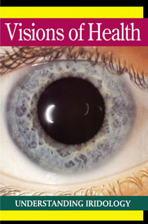 Visions of Health - Understanding Iridology