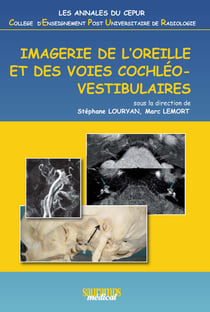 Imagerie de l'oreille et des voies cochléovestibulaires