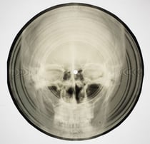 Bone Music - Soviet X-Ray Audio