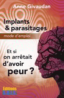 Implants &amp; parasitages – Mode d’emploi