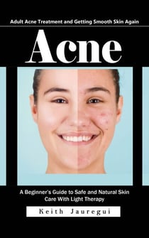 Acne: Adult Acne Treatment and Getting Smooth Skin Again (A Beginner’s Guide to Safe and Natural Skin Care With Light Therapy)