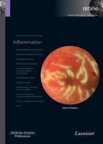 Inflammation - (volume 4 - coffret Rétine)