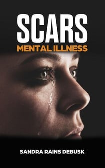 Scars