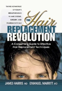 The Hair Replacement Revolution - A Consumer's Guide to Effective Hair Replacement Techniques
