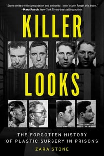Killer Looks - The Forgotten History of Plastic Surgery in Prisons