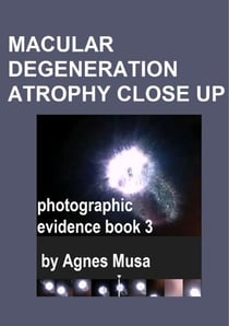 Macular Degeneration Atrophy Close Up, Photographic Evidence Book 3 - Macular Degeneration Atrophy, Photographic Evidence Series of   Books, #19
