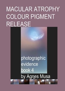 Macular Atrophy Colour Pigment Release, Photographic Evidence Book 4 - Macular Degeneration Atrophy, Photographic Evidence Series of   Books, #15