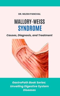 Mallory-Weiss Syndrome: Causes, Diagnosis, and Treatment - GastroPath: Unveiling Digestive System Diseases, #8