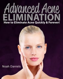 Advanced Acne Elimination - How to eliminate Acne Quickly & Forever!