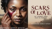 SCARS OF LOVE:  My Journey from Pain to Purpose