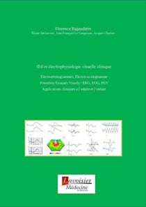 OEil et électrophysiologie visuelle clinique - Électrorétinogrammes, Électro-oculogramme. Potentiels Évoqués Visuels : ERG, EOG, PEV....