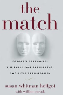 The Match - Complete Strangers, a Miracle Face Transplant, Two Lives Transformed