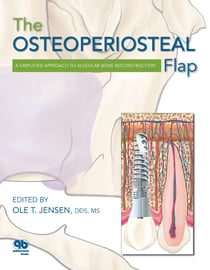 The Osteoperiosteal Flap - A Simplified Approach to Alveolar Bone Reconstruction