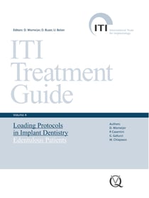 Loading Protocols in Implant Dentistry - Edentulous Patients