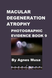 Macular Degeneration Atrophy, Photographic Evidence Book 9 - Macular Degeneration Atrophy, Photographic Evidence Series of   Books, #10