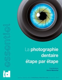 La photographie dentaire etape par etape