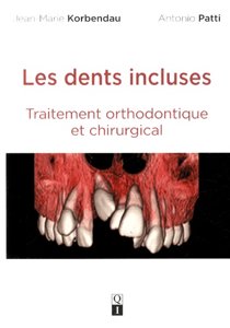 Les dents incluses - traitement orthodontique et chirurgical