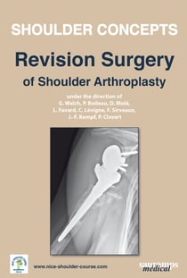 Shoulder concepts - revision surgery of shoulder arthroplasty 2014