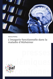 L imagerie fonctionnelle dans la maladie d alzheimer