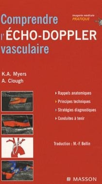 Comprendre l'écho-doppler vasculaire