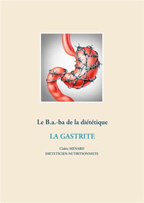 Le b.a.-ba de la diététique - la gastrite