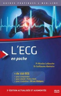 L'ecg en poche med-line 3 ed