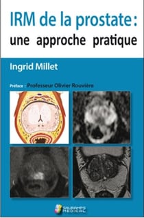 IRM de la prostate : une approche pratique