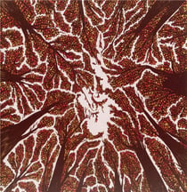 Crown shyness