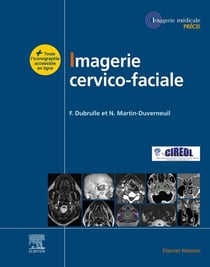 Imagerie cervico-faciale