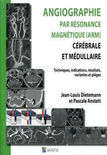Angiographie par résonance magnétique (arm) cérébrale et médullaire - technique, indications, résultats, variantes et pièges