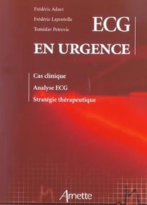 Ecg en urgence