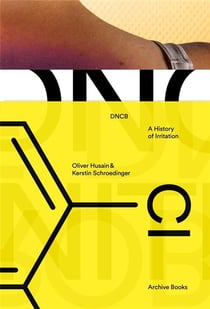 DNCB : a History of Irritation