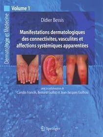 Manifestations dermatologiques de collectivites, vasculites et affections systémiques apparentées