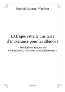 L'Afrique est-elle une terre d'intolérance pour les albinos ?