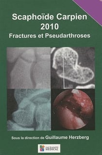 Scaphoïde carpien - fractures et pseudoarthroses (édition 2010)