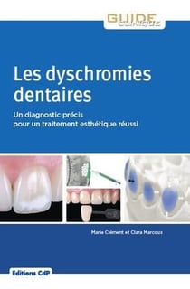 Les dyschromies dentaires - un diagnostic précis pour un traitement esthétique réussi