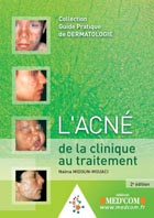 L'acné: de la clinique au traitement (2e édition)