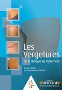 Les vergétures : de la clinique au traitement