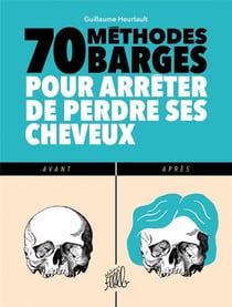 70 methodes barges pour arrêter de perdre ses cheveux