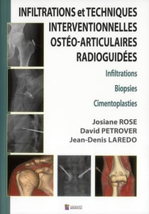 Infiltrations et techniques interventionnelles osteo-articulaires radioguidees