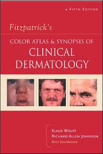 Fitzpatrick's color atlas and synopsis of clinical dermatology - 5th rev ed