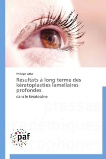 Résultats à long terme des kératoplasties lamellaires profondes