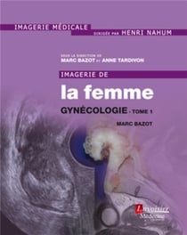 Imagerie de la femme : gynécologie